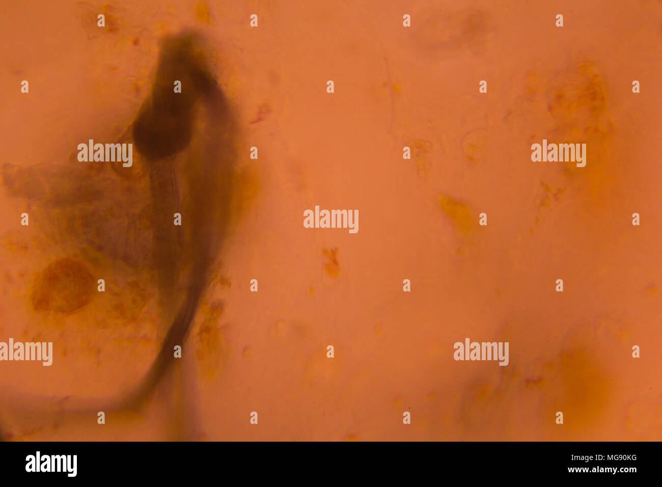 Bacteria under the microscope Stock Photo Alamy