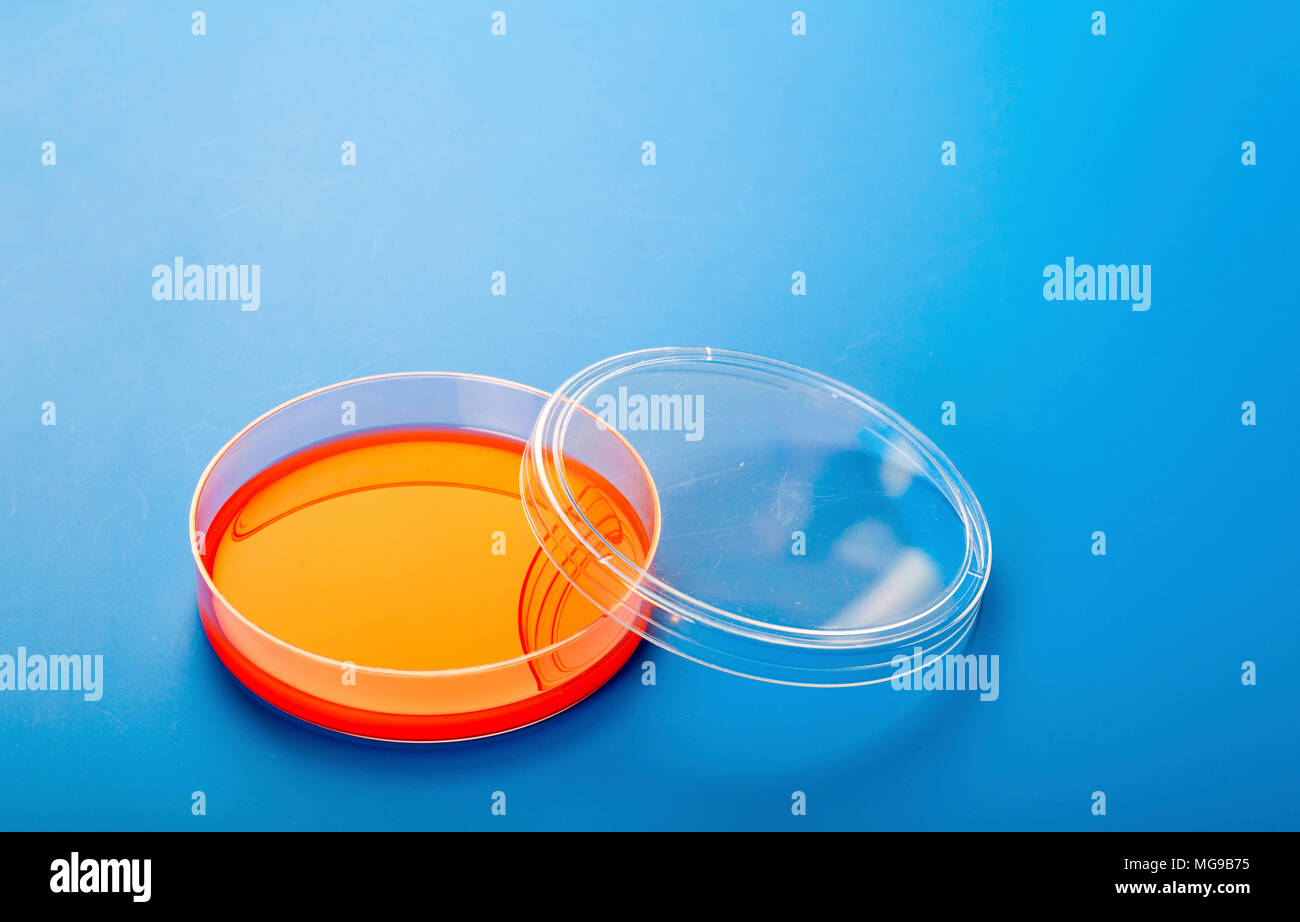 Petri dishes with blood agar Stock Photo Alamy