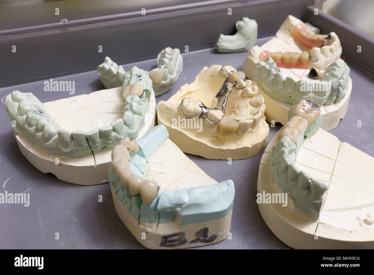 Different types of dental models of the human mouth and teeth. Stock Photo