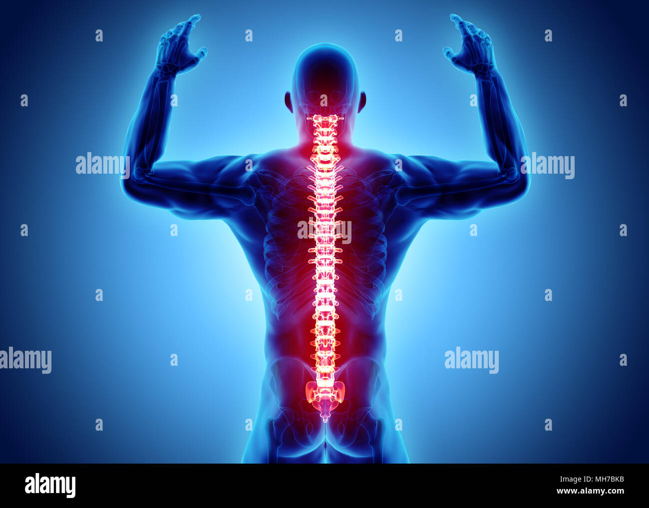 3D Illustration of sacral and cervical painful, medical concept. Stock Photo