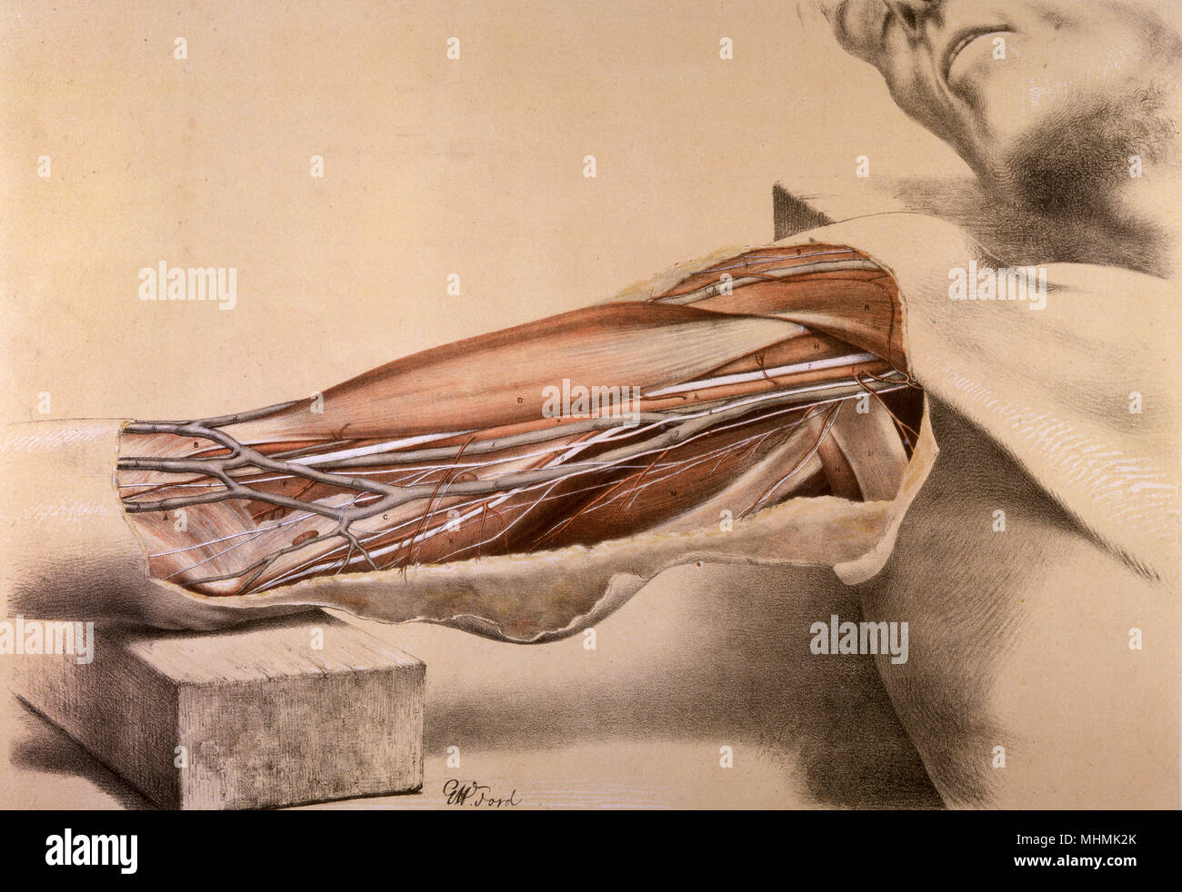 Superficial view of the arm on the inner side, with the parts undisturbed.      Date: 1867 Stock Photo