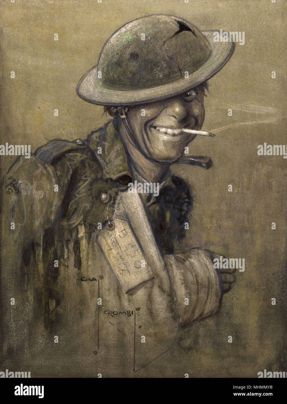 'A Blighty One' by Charles Crombie. A cheery First World War British Tommy, happy to have received a 'blighty' wound (one bad enough to warrant being sent ...