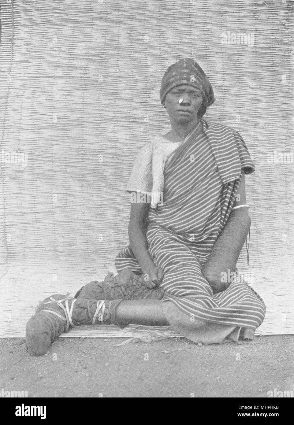 WEST AFRICA. West Africa. The Application of Henna; dye is applied by Hausa 1900 Stock Photo