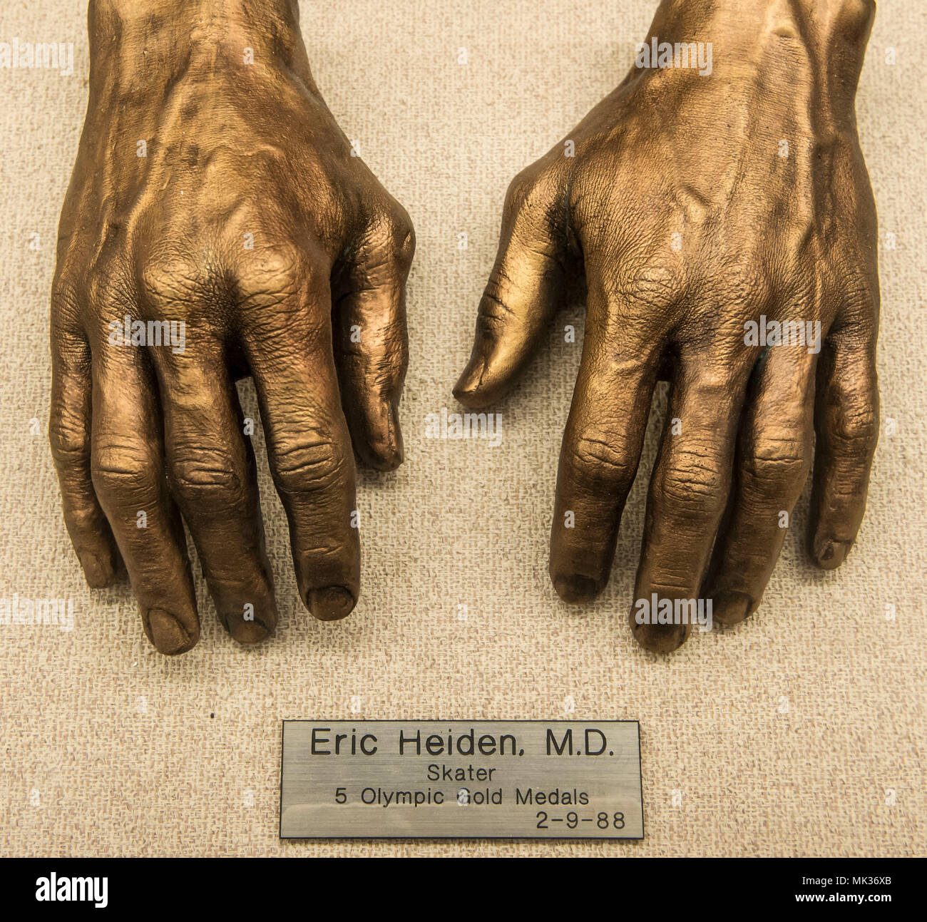 Dallas, Texas, USA. 06th May, 2018. The bronzed hands of ice skating great ERIC HEIDEN on display at the George W. Truett Memorial Hospital at the Baylor University Medical Center. The more than 100 bronze cast hands of well known persons from the fields of politics, sports, the arts and exploration were the work of orthopedic surgeon Adrian E. Flatt (1921-2017), whose specialty was hand surgery. Credit: Brian Cahn/ZUMA Wire/Alamy Live News Stock Photo