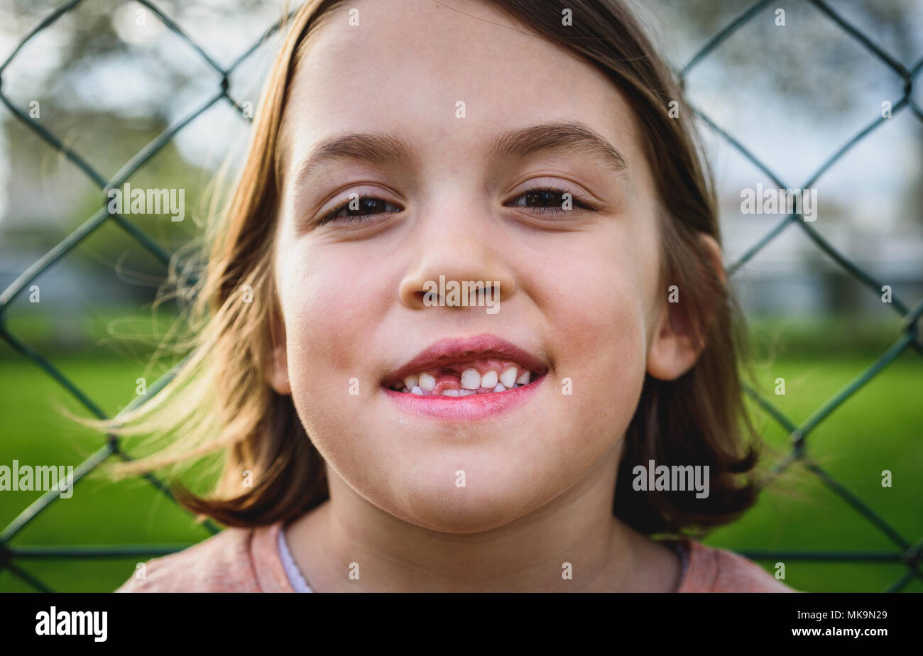 Portrait of toothless child girl missing milk and permanent teeth. Closeup of young kid with teeth gaps and growing permanent teeth and healthy gums p Stock Photo