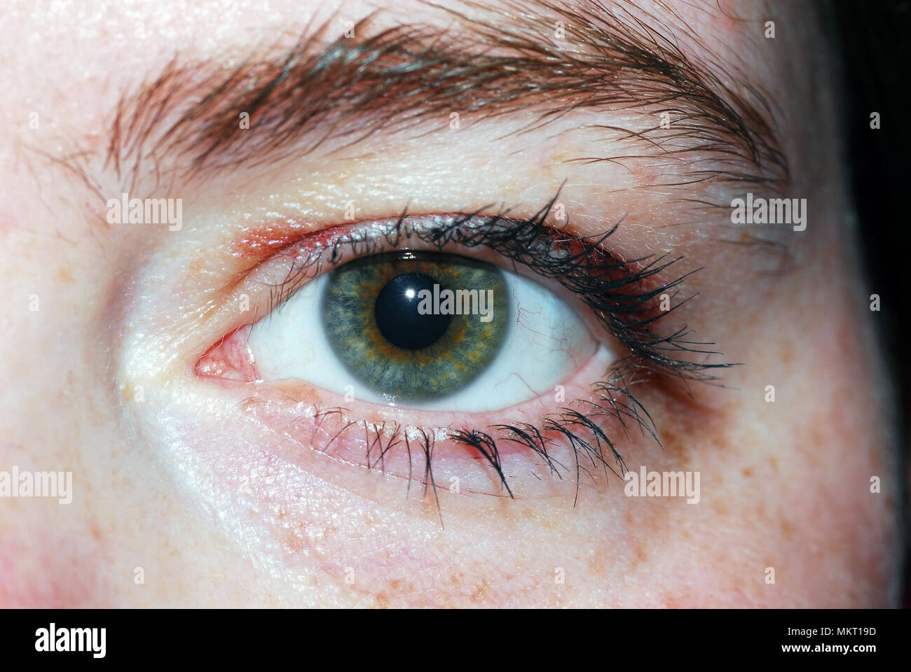 Limbal ring hi-res stock photography and images - Alamy