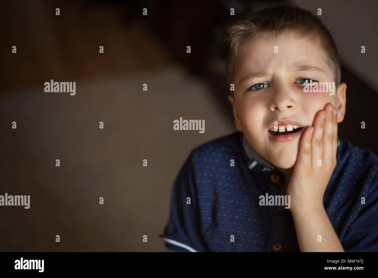 A boy with a black eye Stock Photo - Alamy