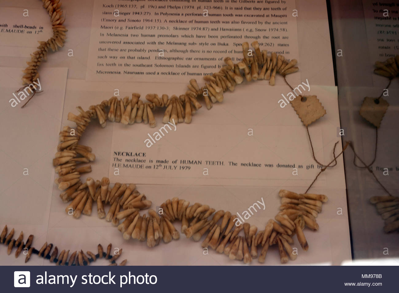 Human Teeth Necklace