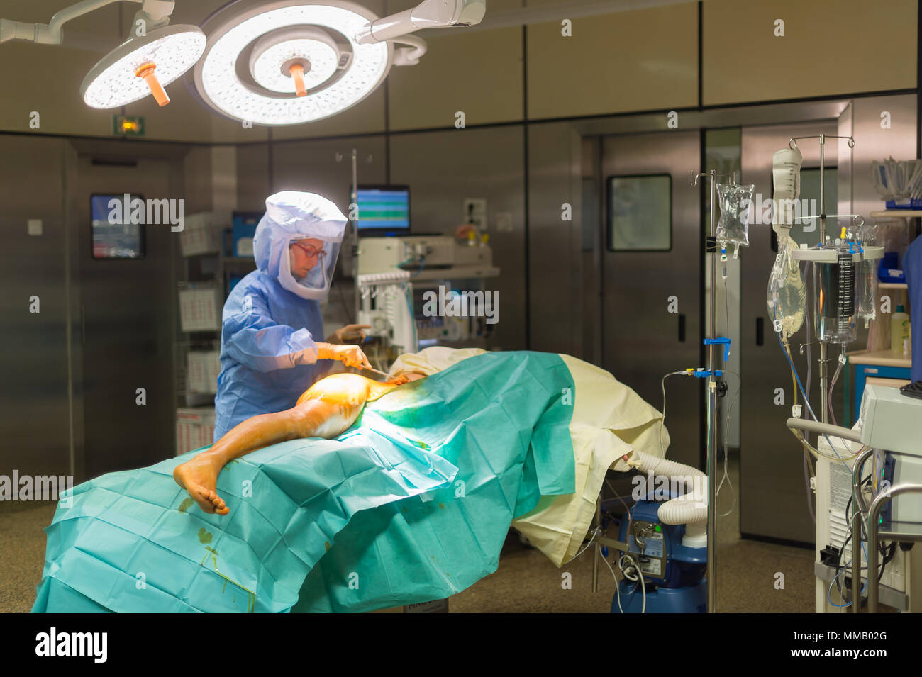 hip-prosthesis-surgery-stock-photo-alamy
