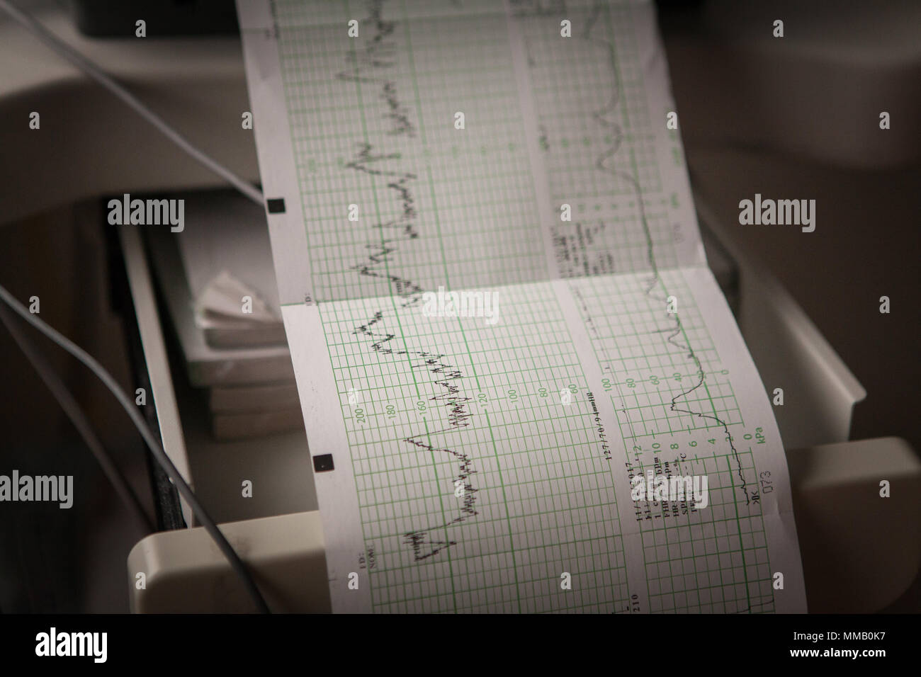 Maternity hospital contractions hires stock photography and images Alamy