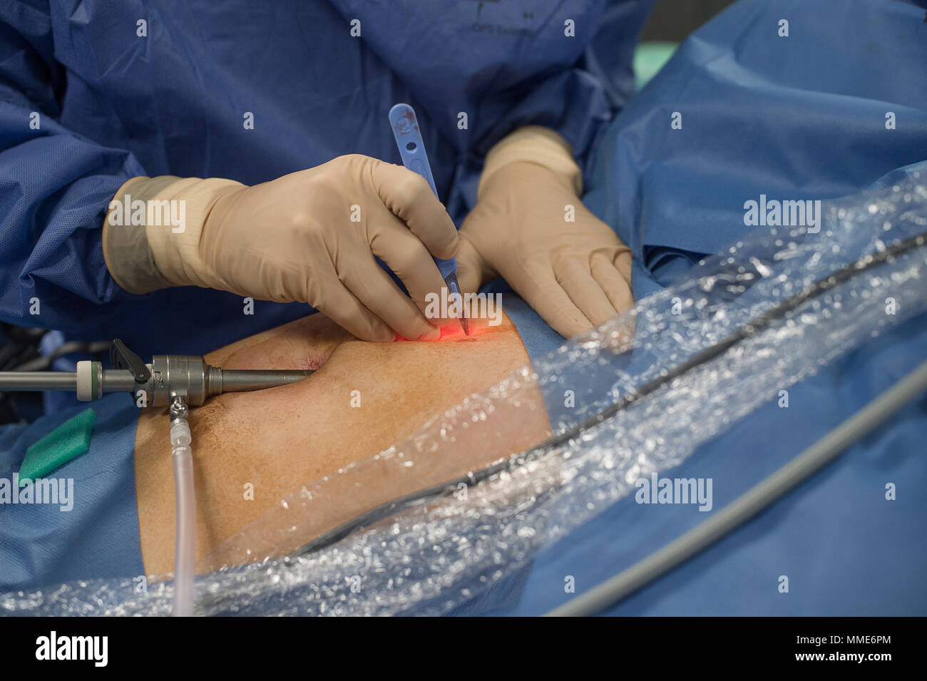 ENDOMETRIOSIS EXAMINATION Stock Photo