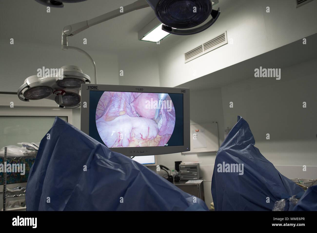 Endometriosis laparoscopy surgery hires stock photography and images