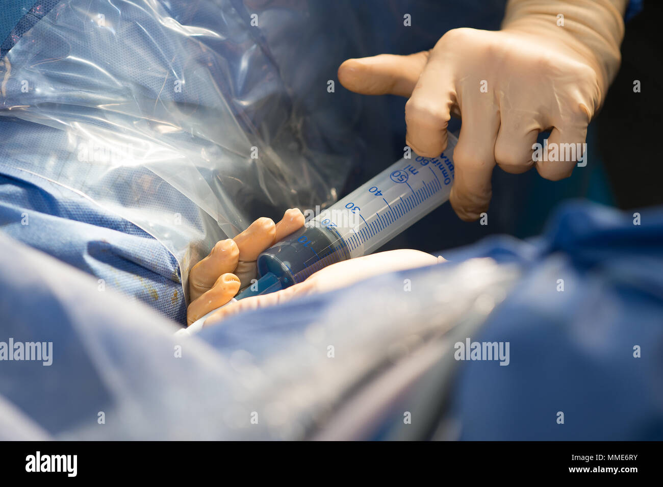 Endometriosis laparoscopy surgery hires stock photography and images