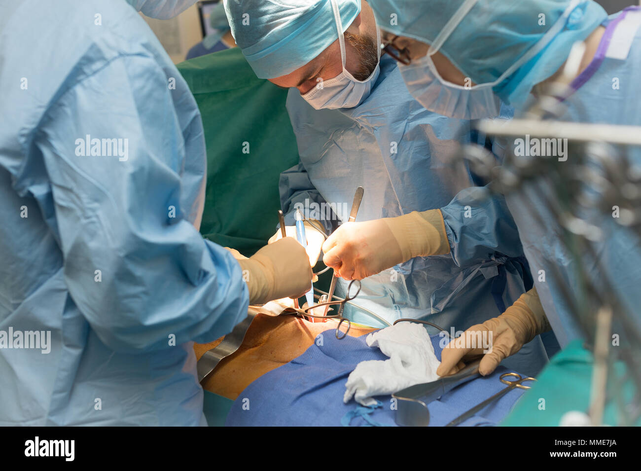 KIDNEY TRANSPLANT Stock Photo