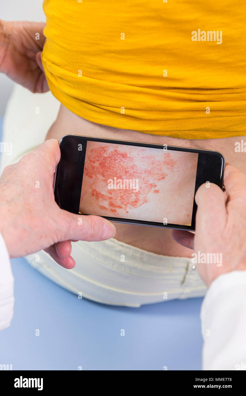 Dermatology monitor hires stock photography and images Alamy