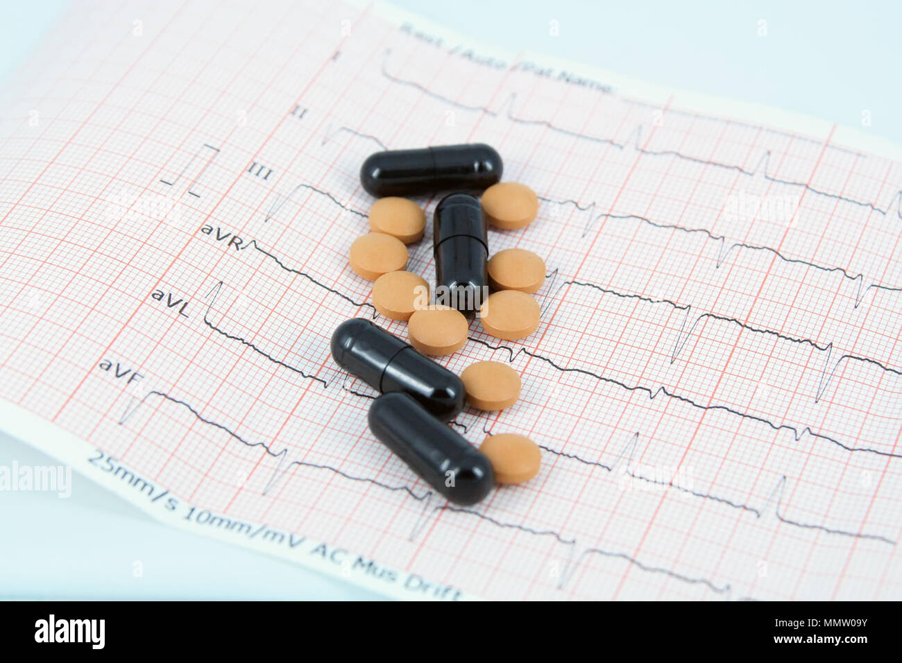 Stress test ecg ekg hi-res stock photography and images - Alamy