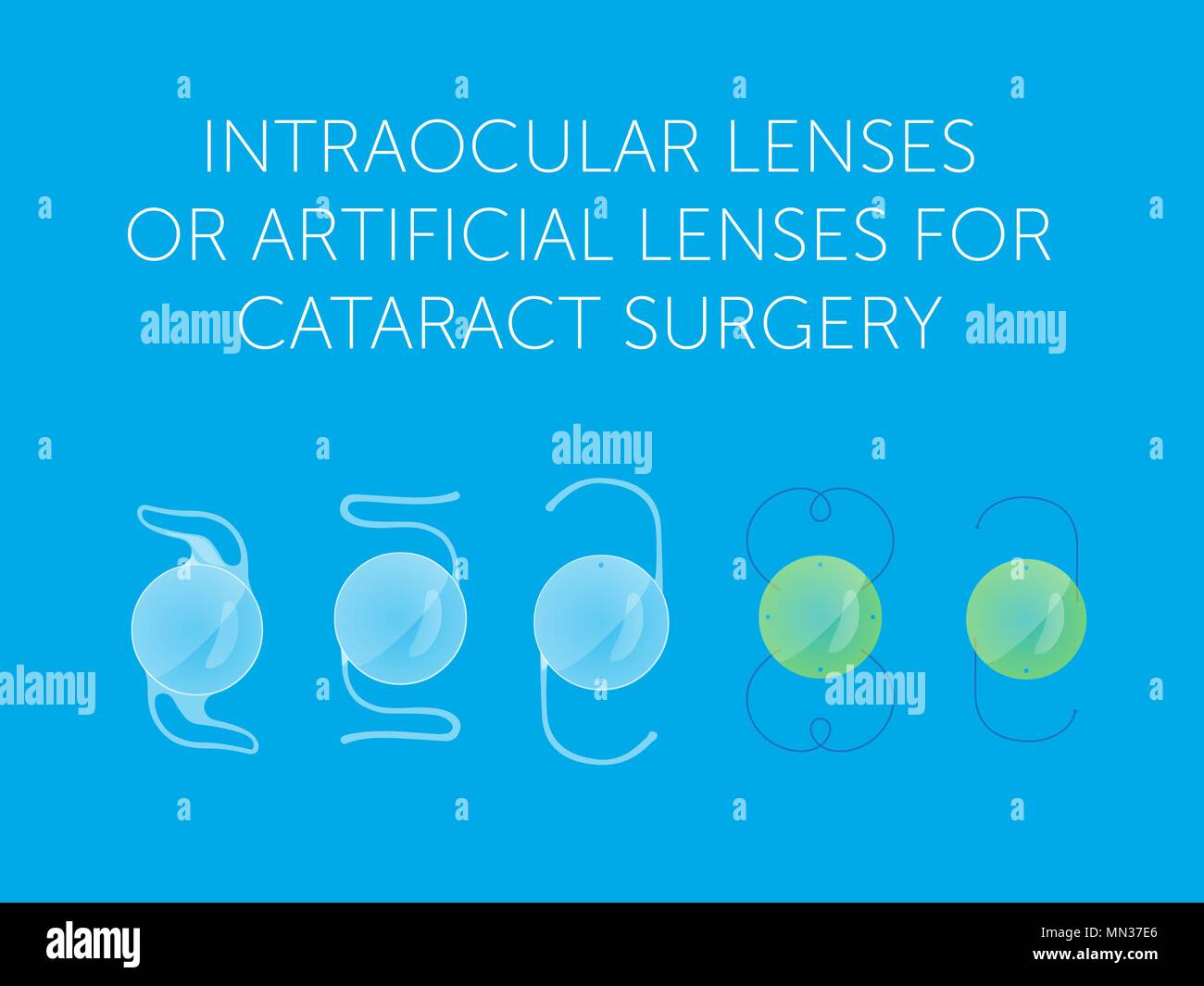set of species Intraocular lenses or artificial lenses for cataract surgery on a blue background Stock Vector