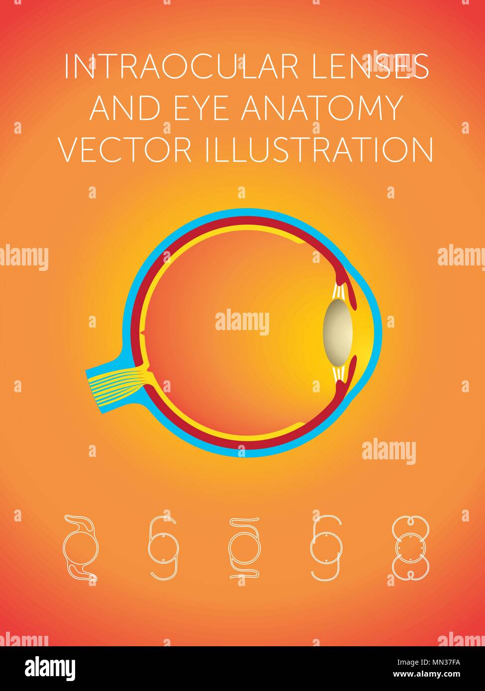 Schematic structure of eye and types of intraocular lenses on orange background Stock Vector