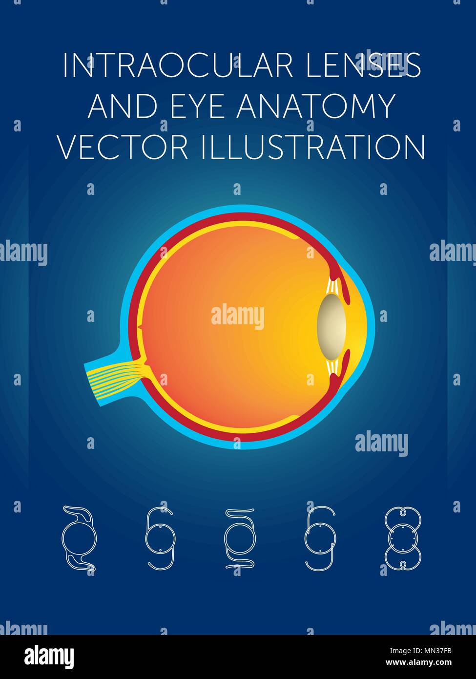 Schematic structure of eye and types of intraocular lenses on blue background Stock Vector