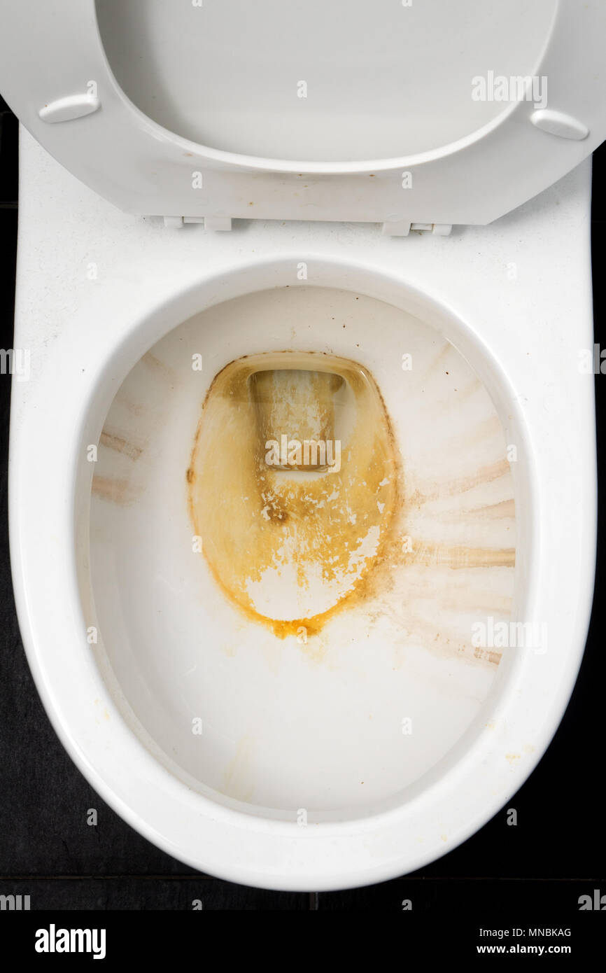 Overhead view of a dirty toilet bowl. Stock Photo