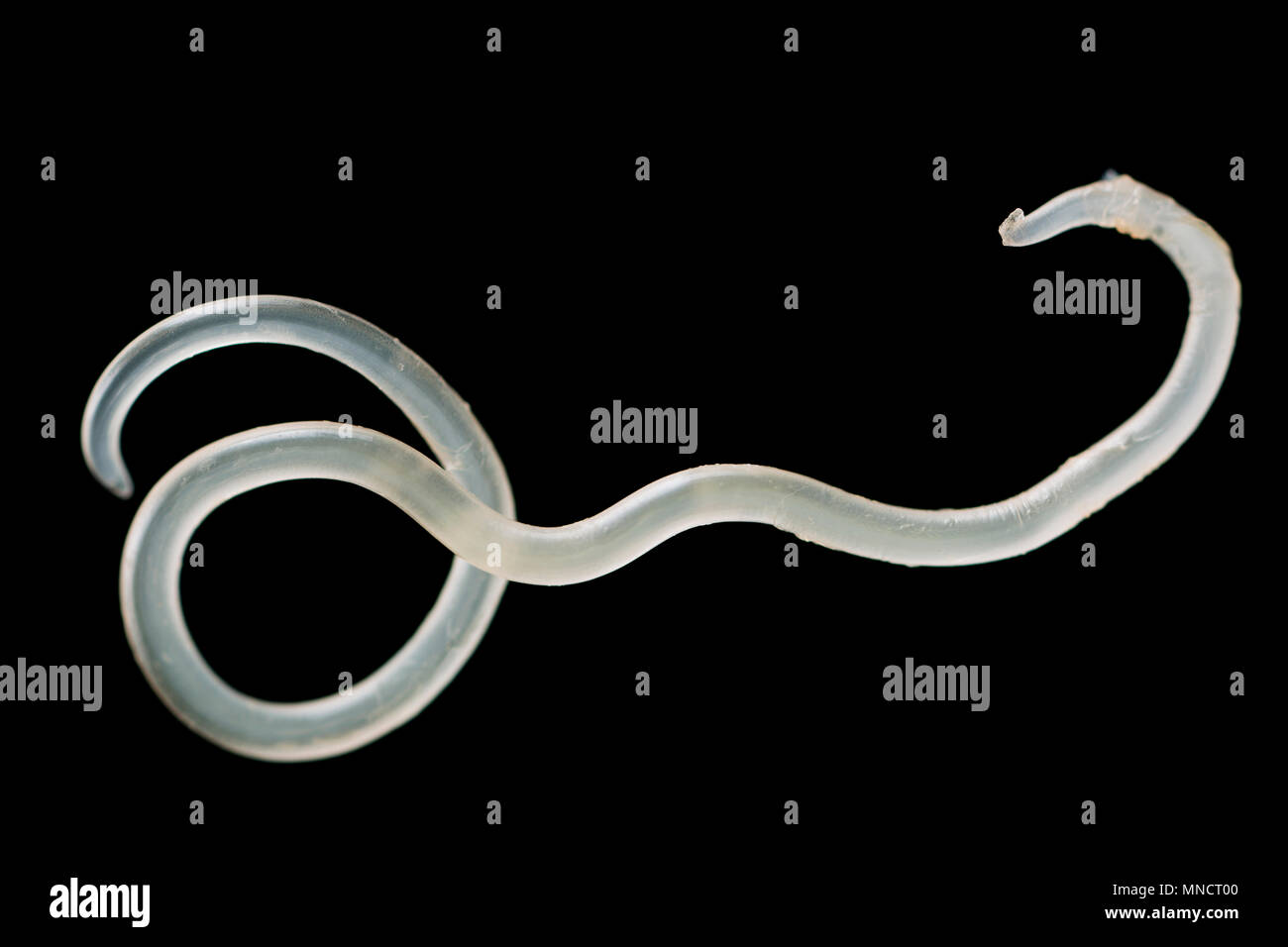 A parasitic nematode, or roundworm, that has been removed from the surface of a pollack’s liver England UK Stock Photo