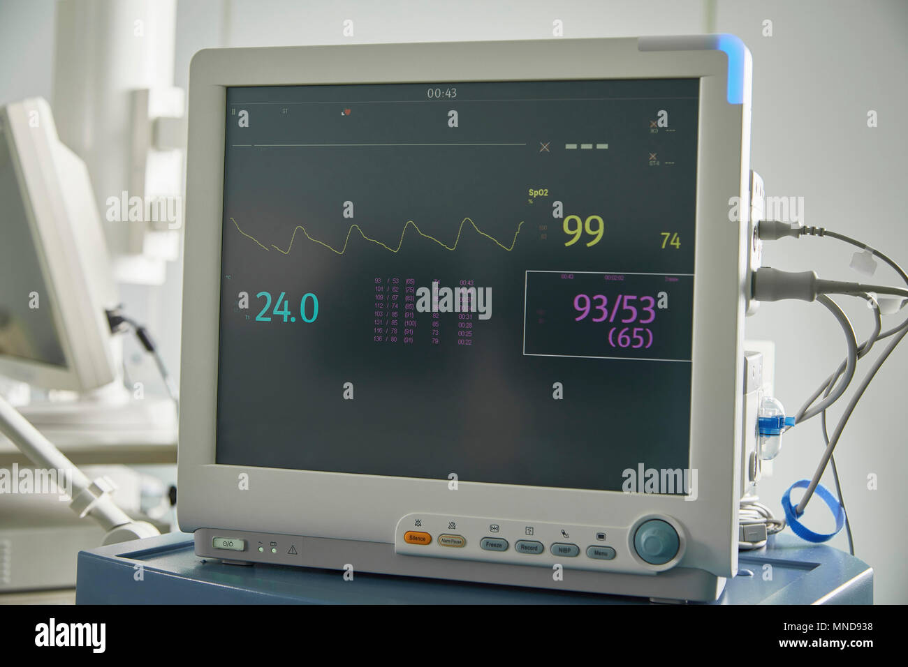 Closeup of monitoring equipment with medical data on screen in hospital ward Stock Photo Alamy