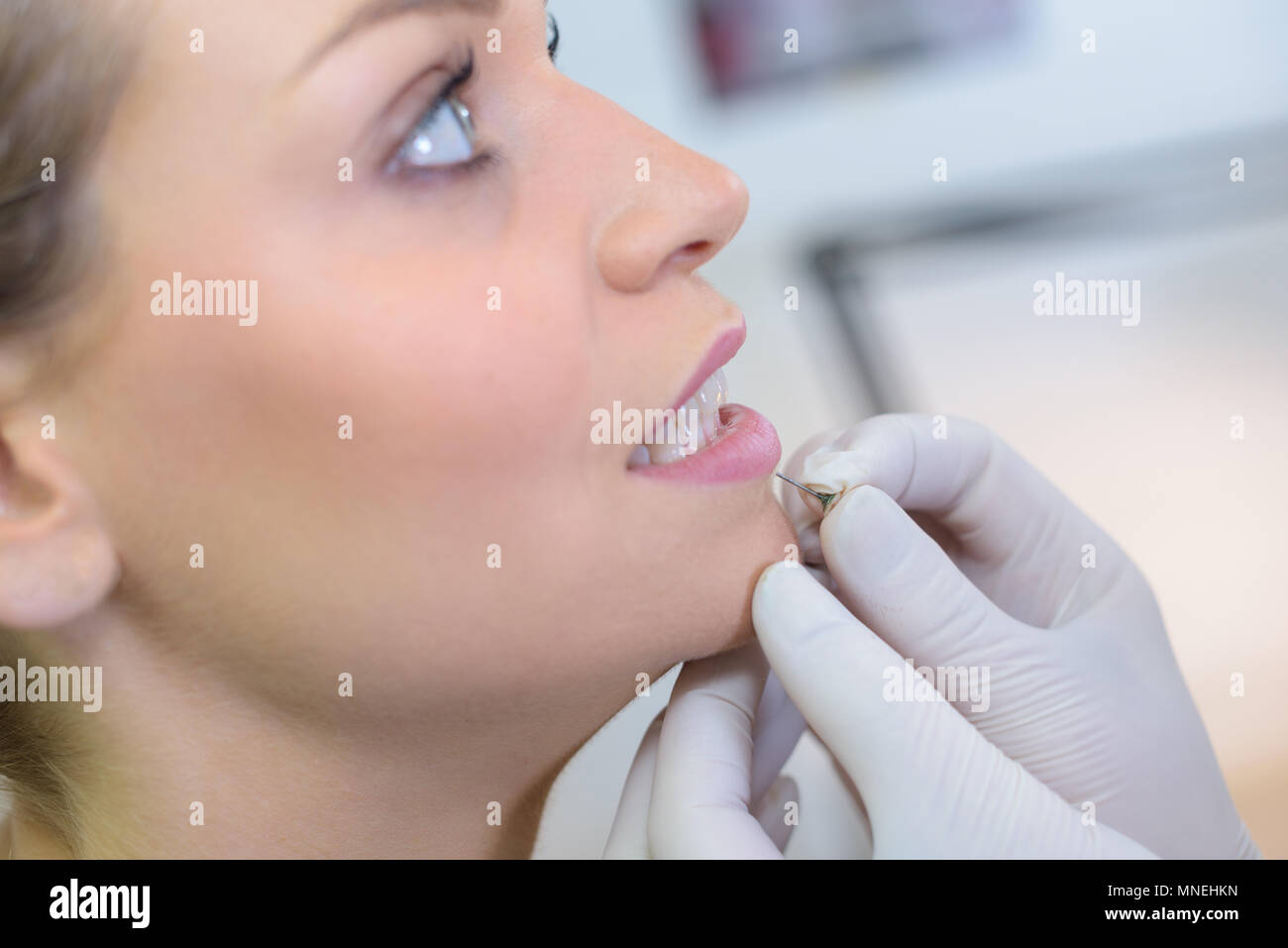 Lips augmentation syringe female hi-res stock photography and images ...
