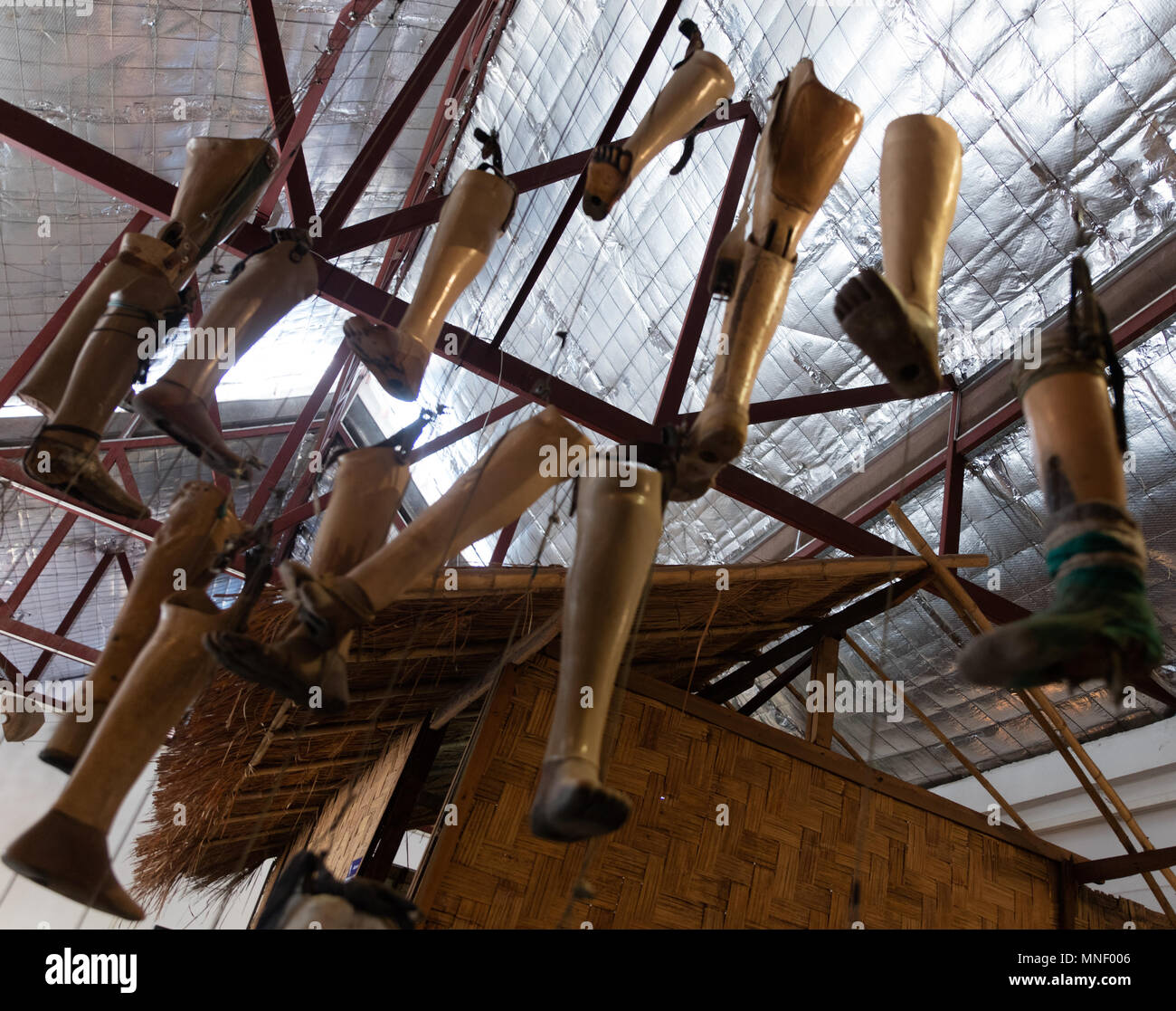 Luang Prabang, Laos, November 2016.Limb prosthetes exposed in The UXO Lao Visitor Centre Stock Photo