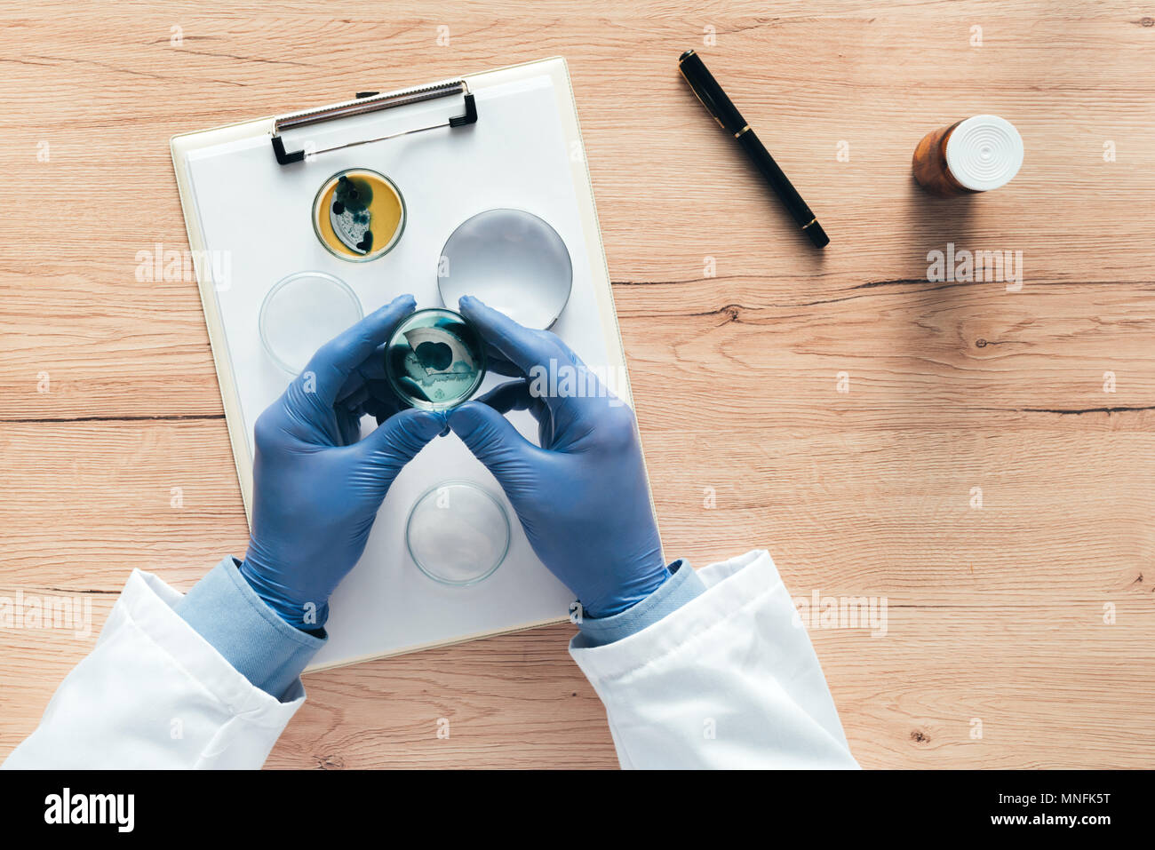 Overhead view of laboratory technician analyzing growing bacterial cultures in petri dish, science and microbiology background Stock Photo