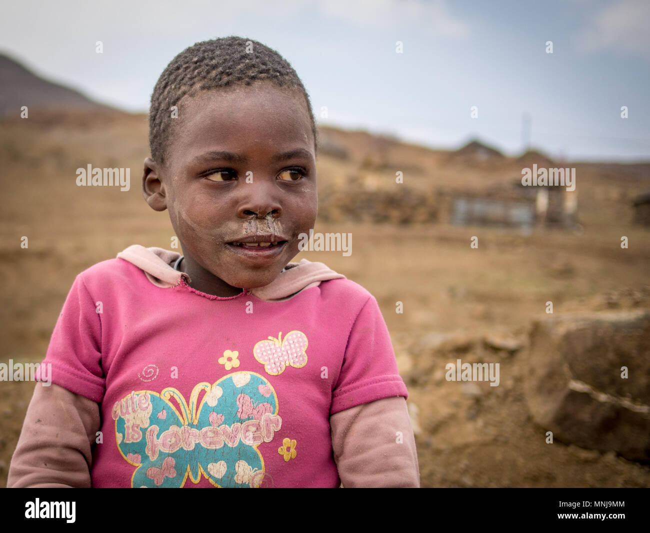 Mokhotlong, Lesotho - September 11, 2016: Unidentified young African girl with short hair and running nose Stock Photo