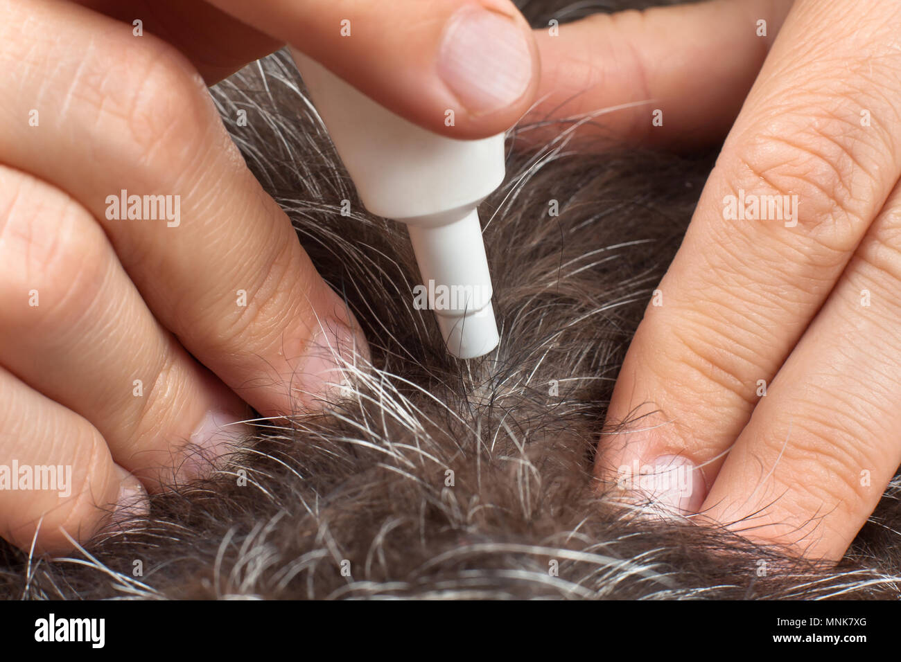 hand with remedy from fleas and ticks on the fur background Stock Photo