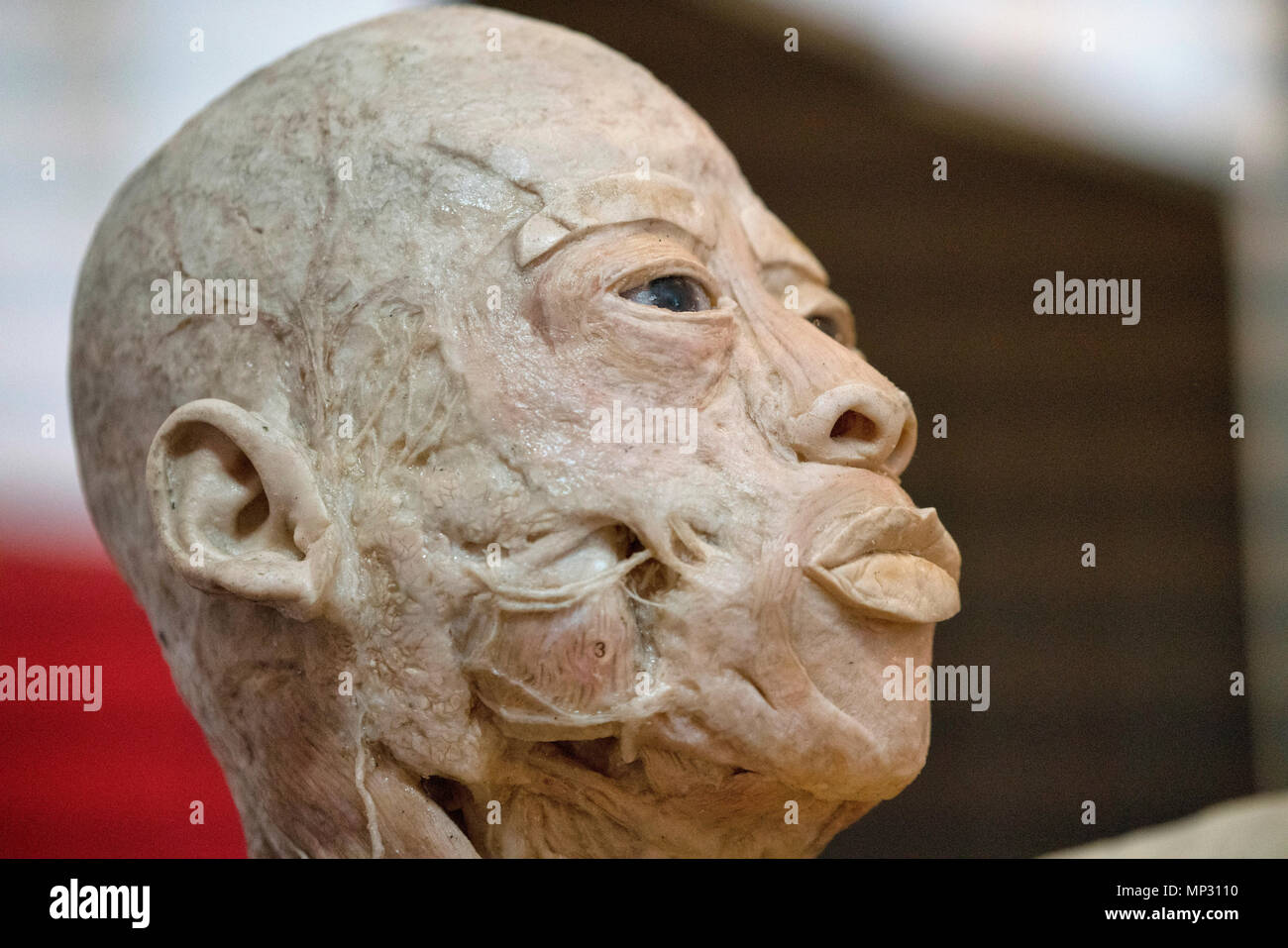 Anatomy of a real human head Stock Photo