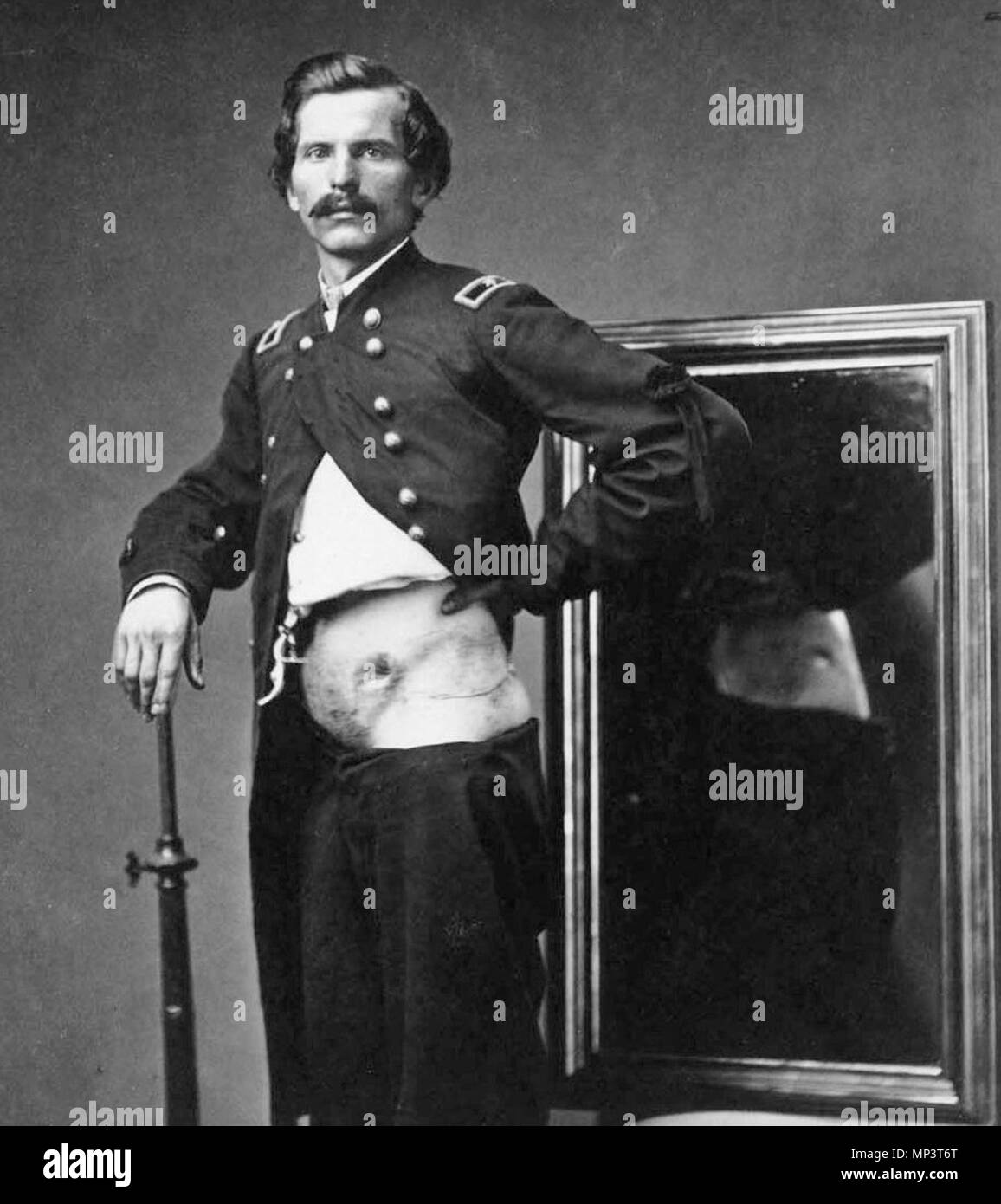 Gunshot wound abdomen Black and White Stock Photos & Images Alamy