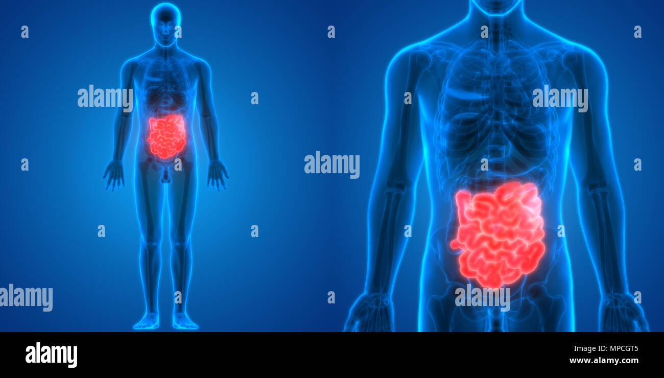 Embolus Small Intestine Fall Cabbage, Botany and Human Pathology