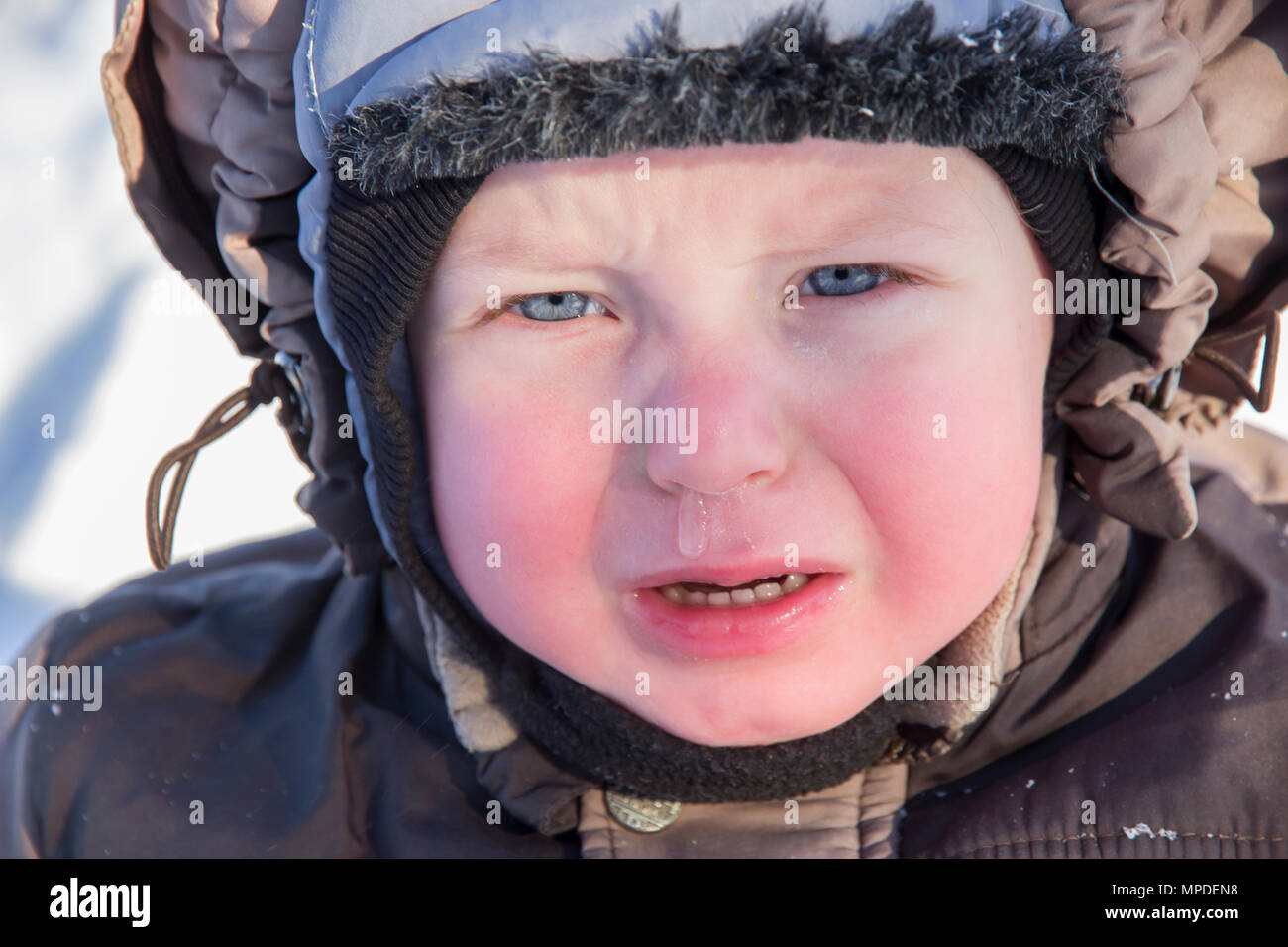 Crying Baby Face With Boogers