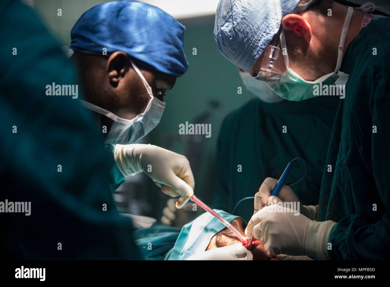 Frontal sinus hires stock photography and images Alamy