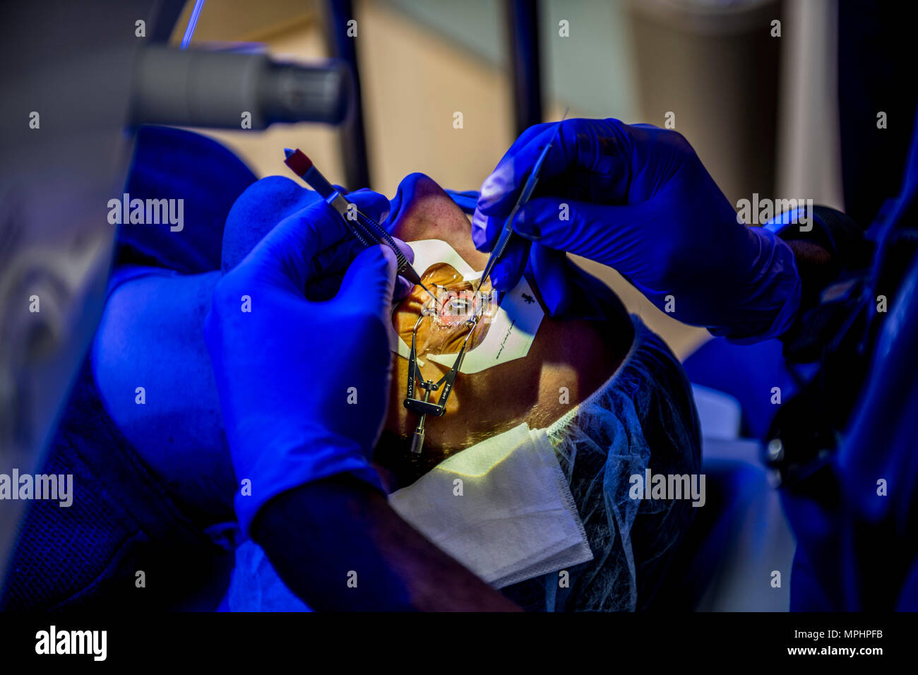 FORT BELVOIR, Va. (March 16, 2017) The Warfighter Refractive Eye