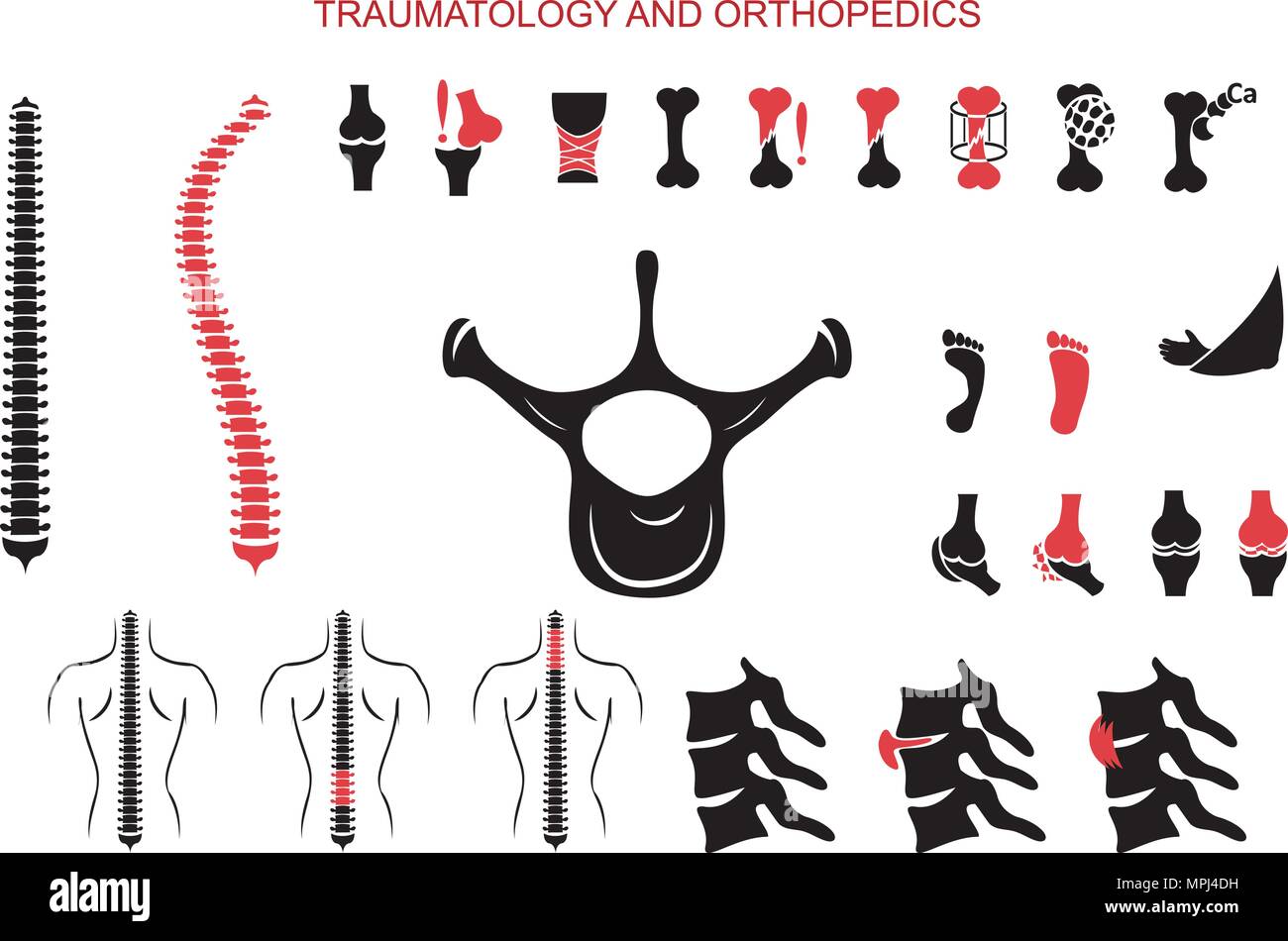 Vertebral compression Stock Vector Images - Alamy