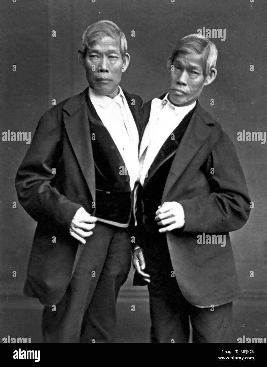 CHANG AND ENG BUNKER (1811-1874) Thai-American twins brothers whose condition and birthplace coined the term 'Siamese twins'. (Chang at right) Stock Photo