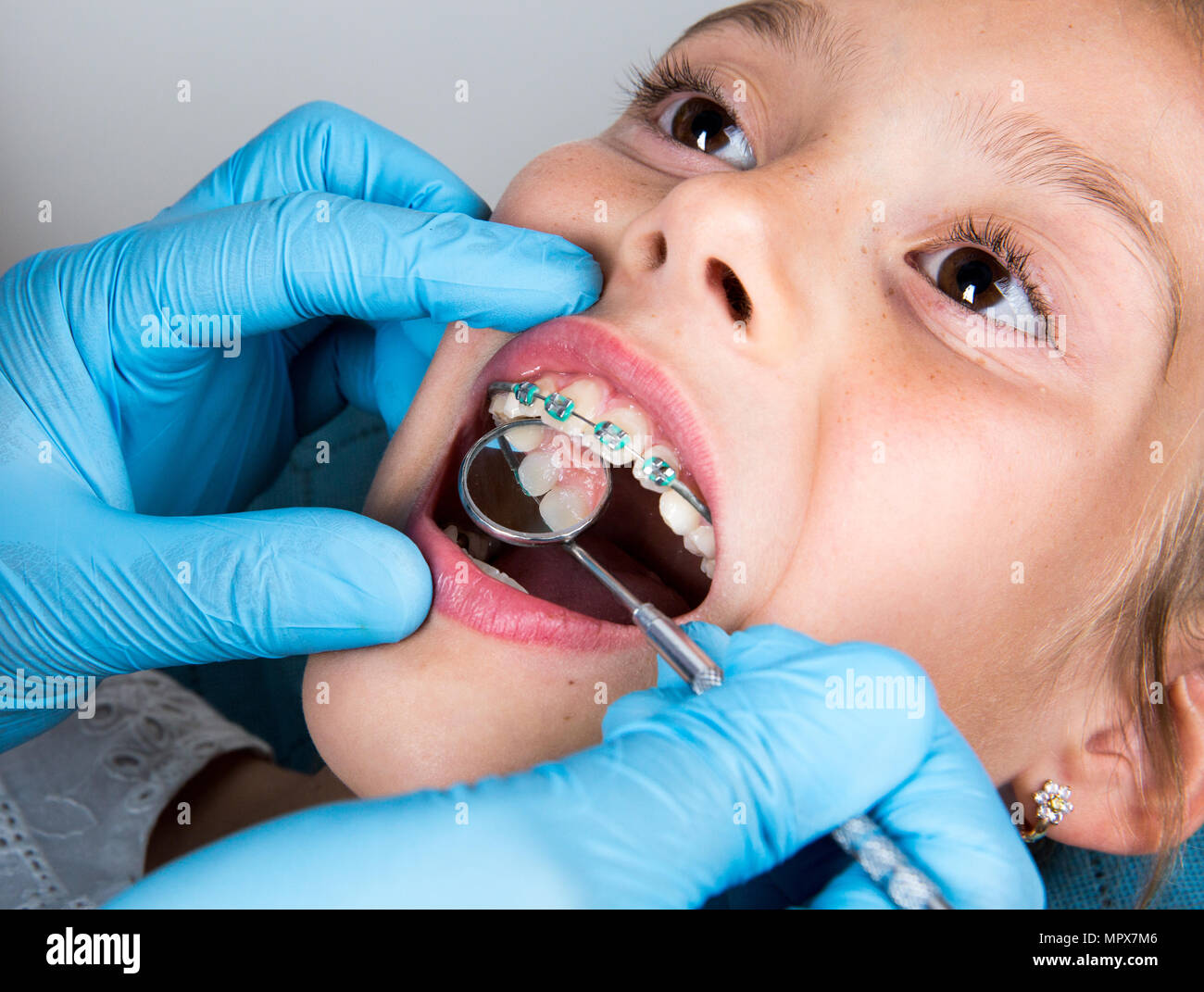 Dentist, Orthodontist examining a little girl patient's teeth Stock Photo