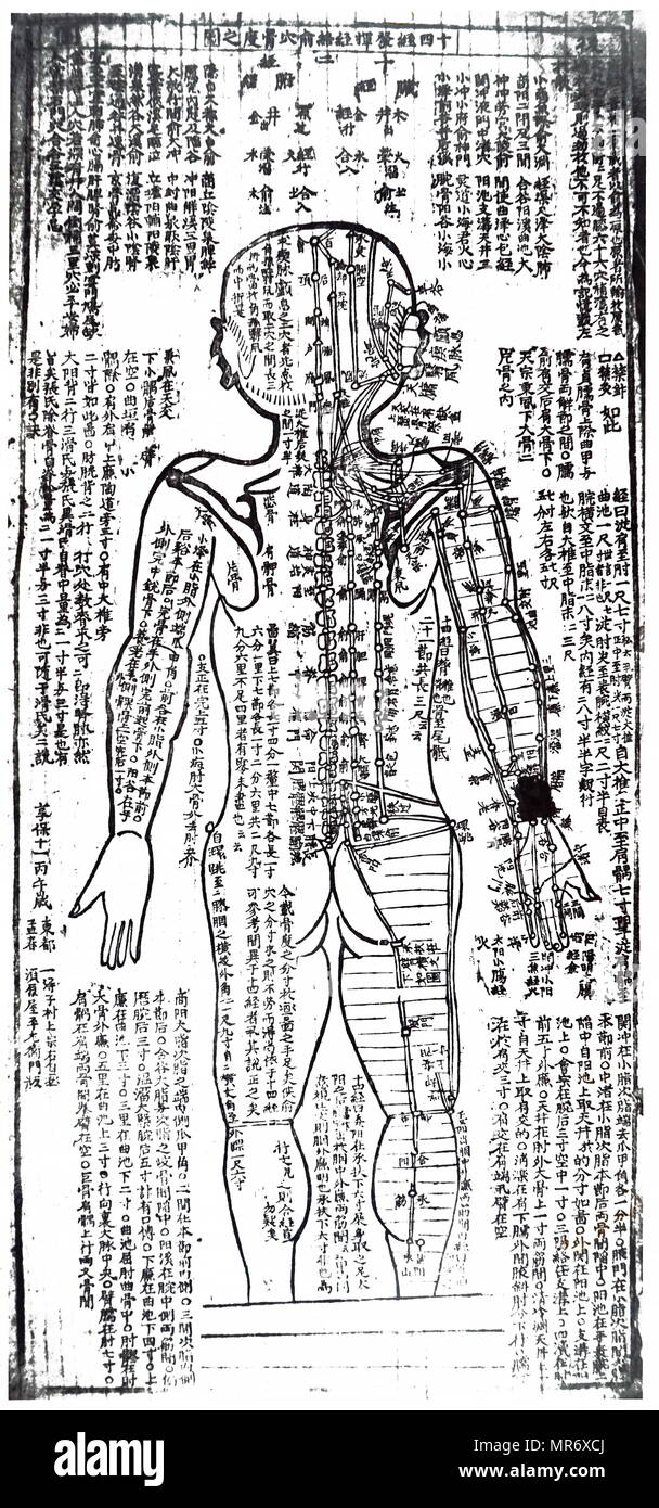 19th century Japanese acupuncture chart. Dated 19th century Stock Photo