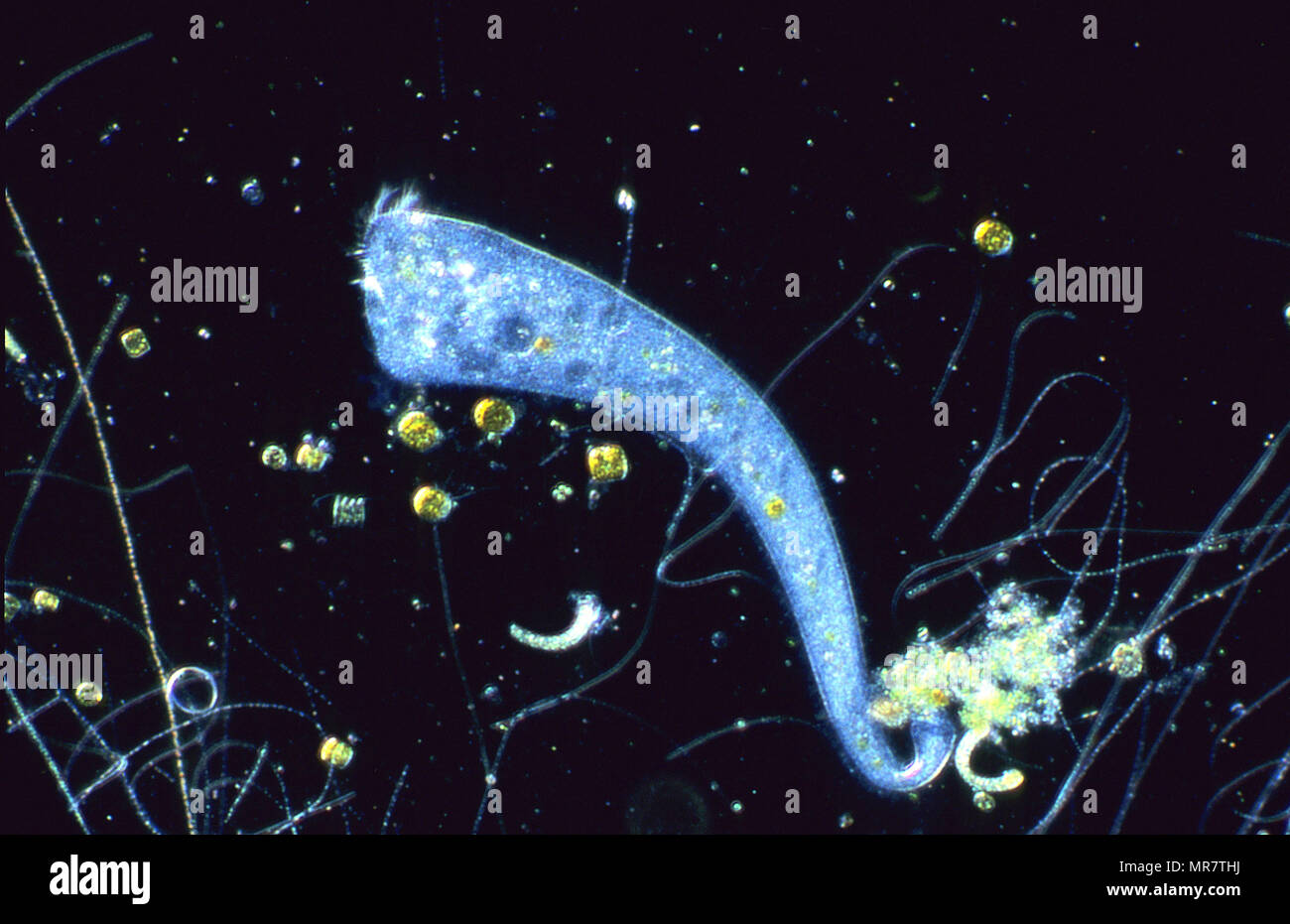 Stentor.Ciliata.Protozoans.Optic microscopy Stock Photo