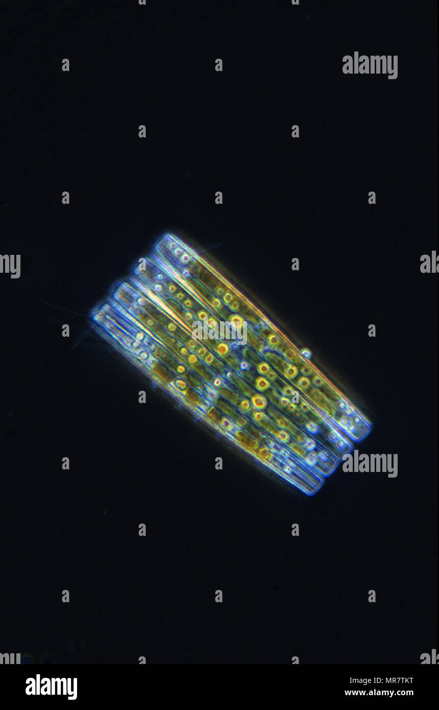 Flagilaria.Diatom.Seawed.Algae.Optic microscopy Stock Photo