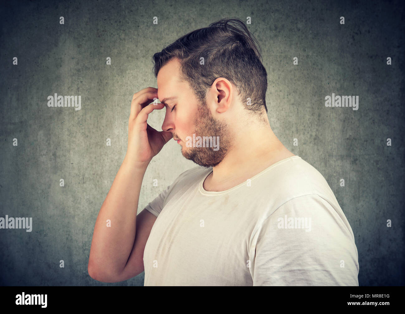 Side view of young overweight man thinking on solution while rubbing forehead. Stock Photo