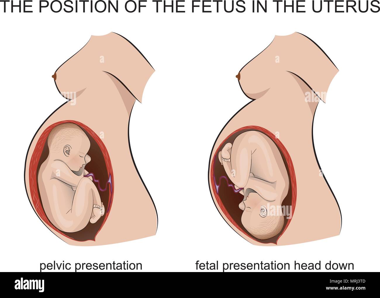 Fetal Position Baby High Resolution Stock Photography And Images Alamy
