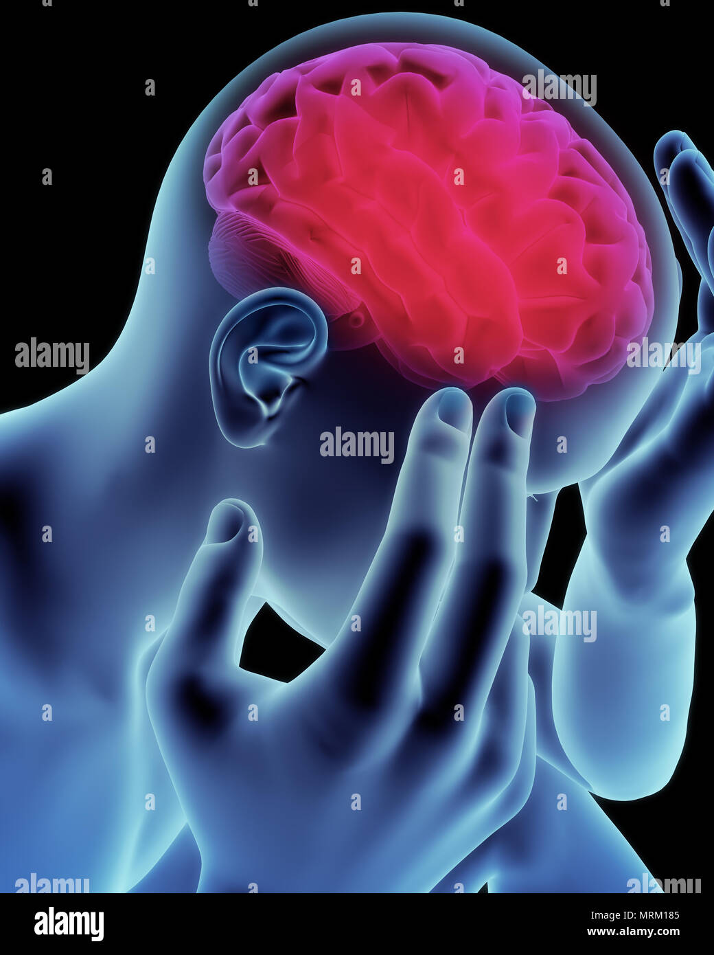 Brain head ache, migraine, Alzheimer's or dementia  concept,Part of a medical series Stock Photo