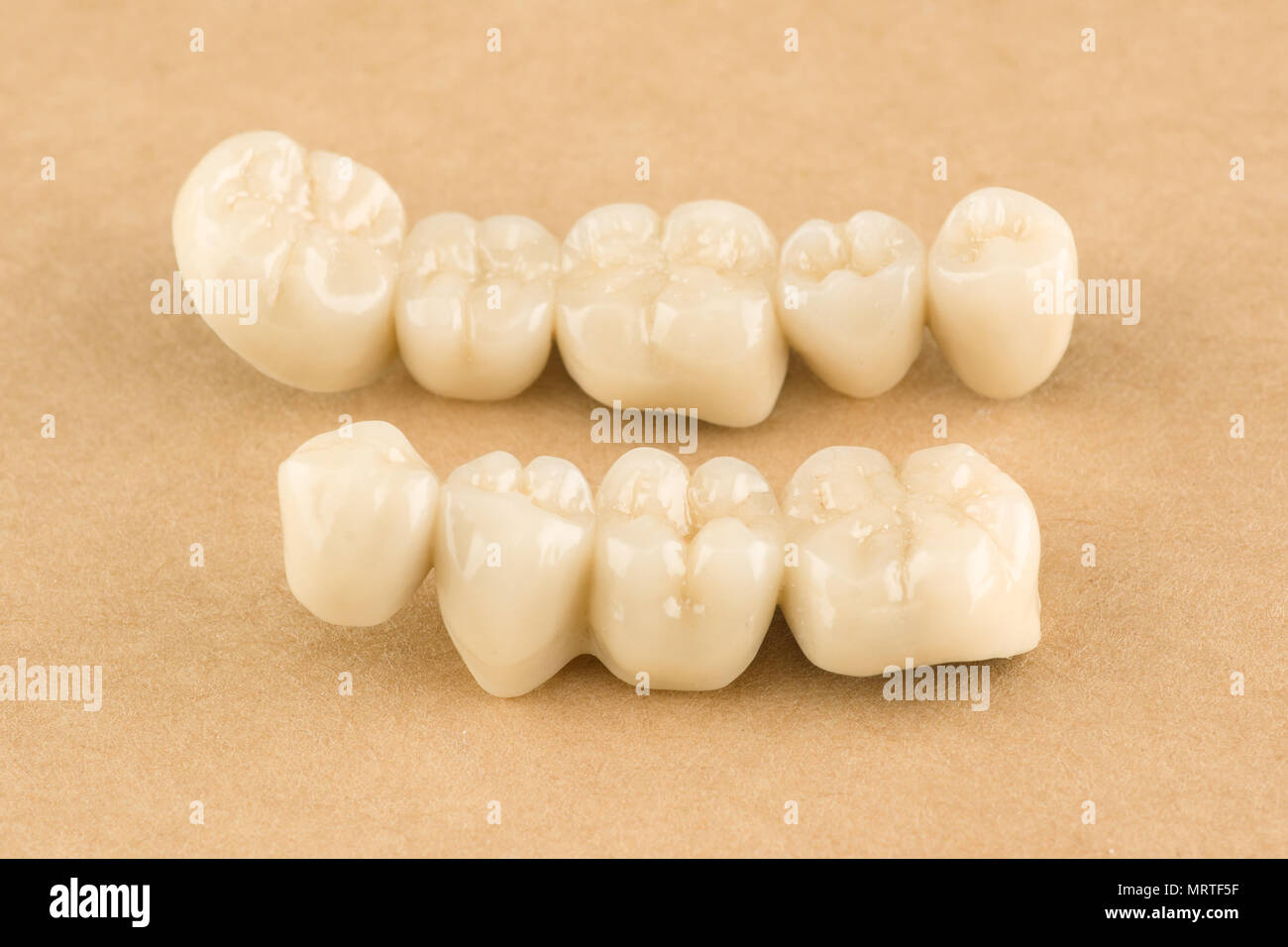 artificial dental structures made of ceramics for restoration of