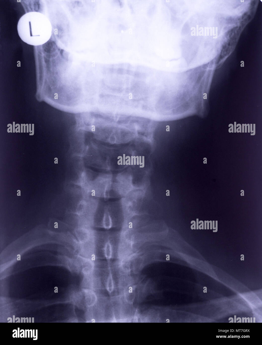 Frontal projection hires stock photography and images Alamy