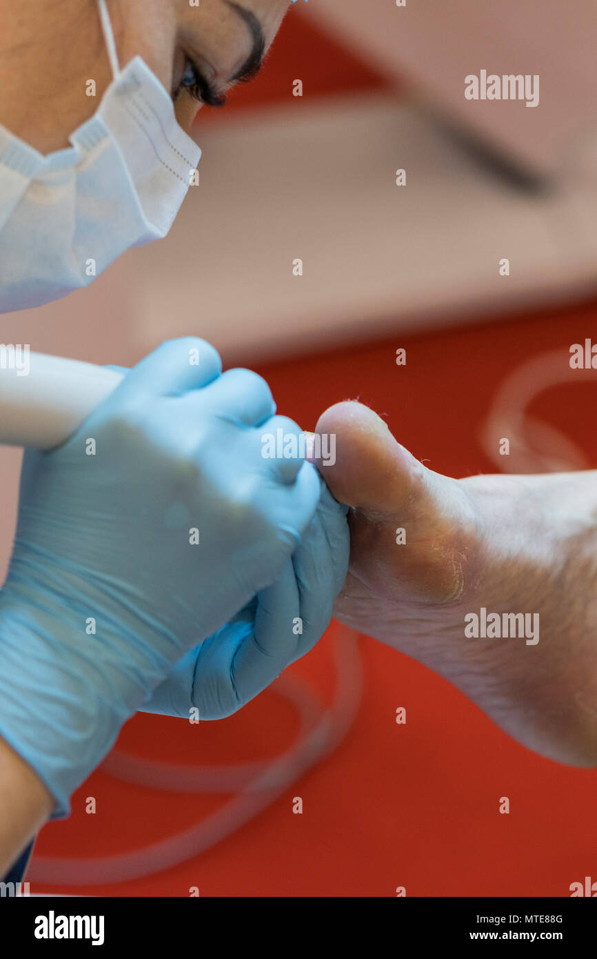 Podiatry doctor. Treatment of feet and nails Stock Photo Alamy