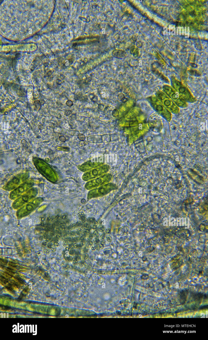 Scenedesmus.Chlorophyta.Algae.Seaweed.Optic micrsocopy Stock Photo